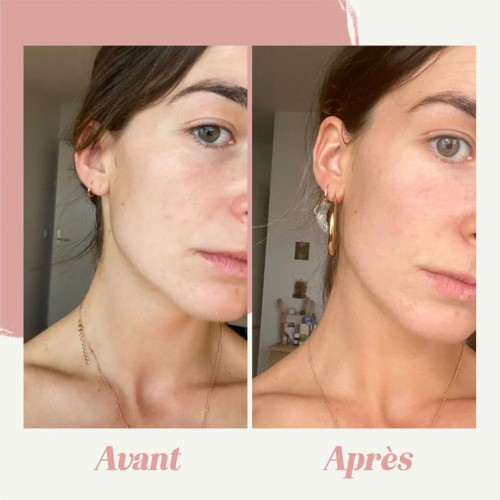 Crème Visage Autobronzante - Teint Halé Naturel & Adapté à Toutes les Peaux
